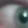 Eye emote