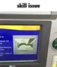 SkillIssue emote
