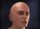 Aneurysm emote