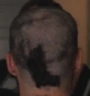 BALD emote
