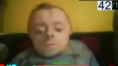 cypekD emote