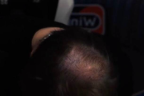 ozero emote