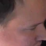 oster) emote