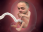 emoneyFetus