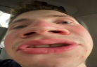 HYPO emote