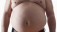 MAST
