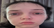 000 emote