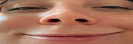 )