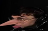 MYNOSE