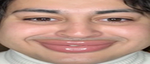 zesty
