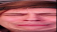 xdd